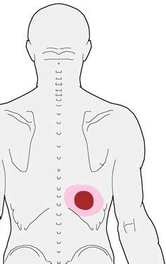 21 Best Rib pain ideas | rib pain, trigger points, pain