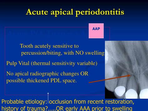 Periodontitis Symptoms Causes Diagnosis And Treatment