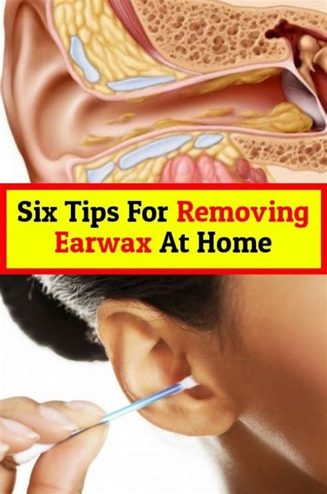 Ear wax removal - imator