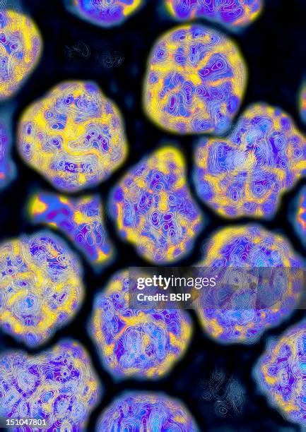 854 Transmission Electron Microscopy Stock Photos, High-Res Pictures, and Images - Getty Images