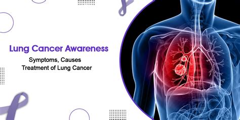 Lung Cancer Causes And Symptoms