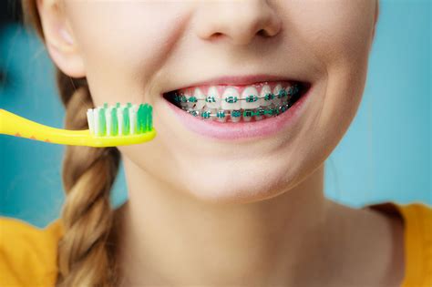 how much do children's braces cost | Jacobus Orthodontics