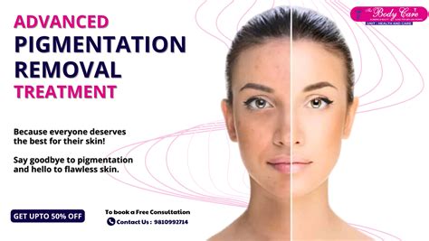 Skin Pigmentation Treatment at The Body Care Clinic: A Guide