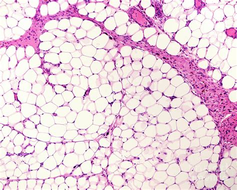 Adipose Tissue Histology