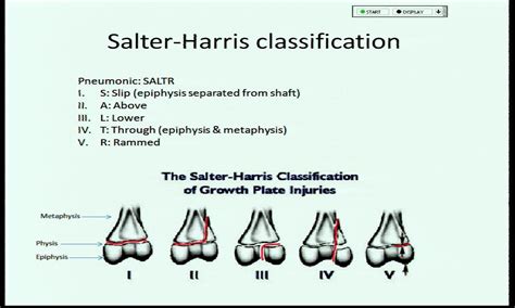 CME 27/11/14 - Paediatric Fractures - Charlie's ED