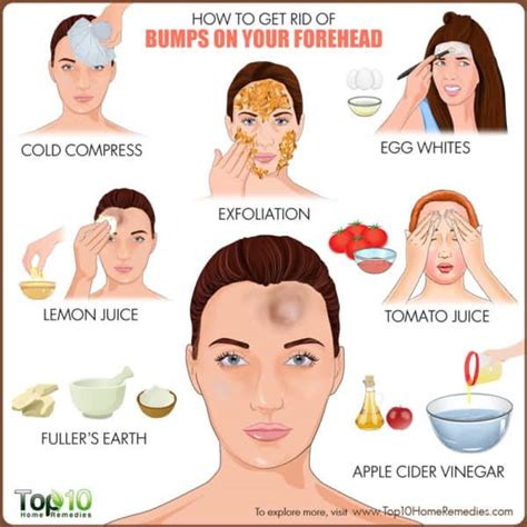 How to Get Rid of Bumps on Forehead | Top 10 Home Remedies