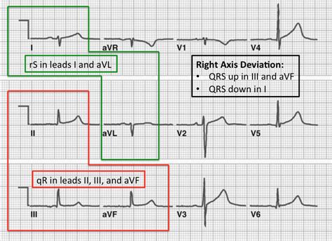 LPFB - REBEL EM - Emergency Medicine Blog