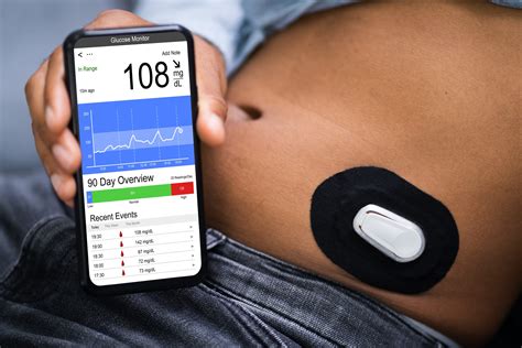 Dexcom Continuous Glucose Monitoring Devices