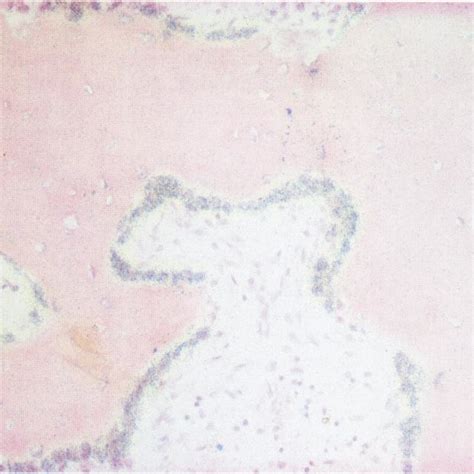 (PDF) Cell adhesion molecules