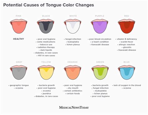 Tongue color: What does it say about health?