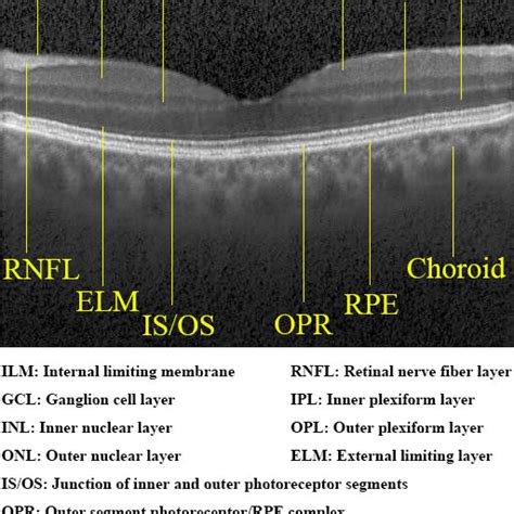 Retinal layers in a synthetic normal OCT image generated by our model.... | Download Scientific ...