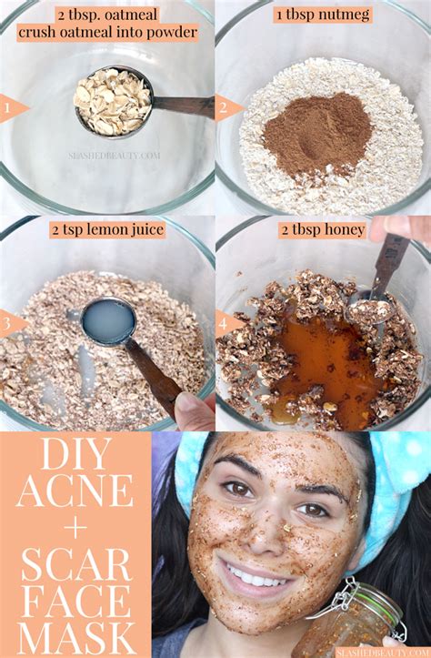 Best DIY Face Mask for Acne & Scars | Slashed Beauty