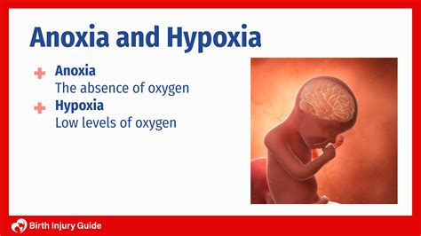 How Anoxia and Hypoxia at Birth Affects Your Baby