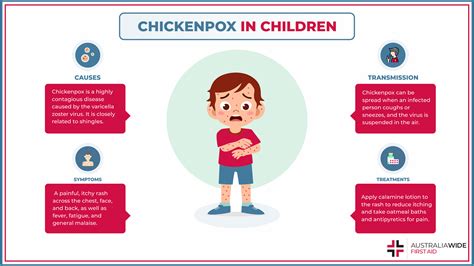 KS1 Chicken Pox Information Leaflet (Teacher-Made) Twinkl, 56% OFF