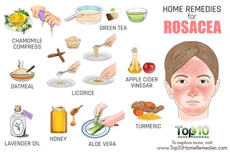 Home Remedies for Rosacea: What You Should Use? | Top 10 Home Remedies | Home remedies for ...