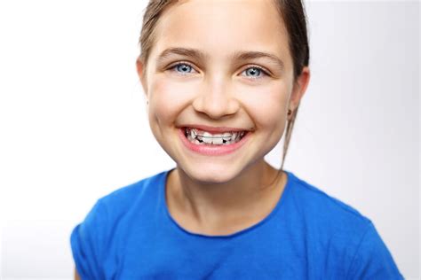 What Age Do Kids Get Braces | Orthodontic Blog | Ortho Buena Park