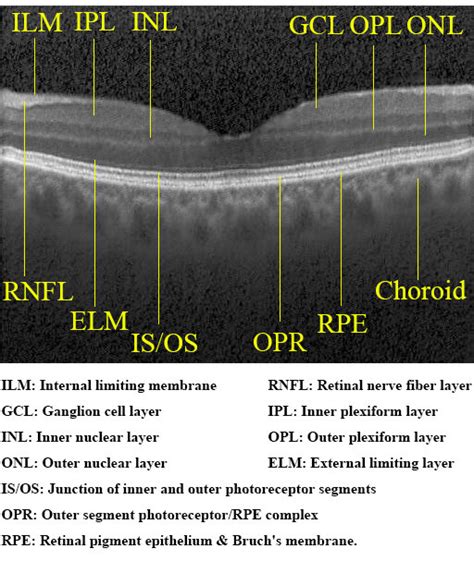 Retinal layers in a synthetic normal OCT image generated by our model.... | Download Scientific ...