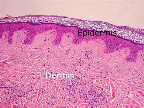 Dermis layers - Structure of dermis | the dynamic natural skin care