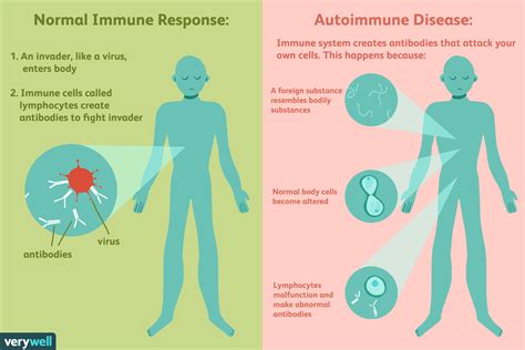 Autoimmune Diseases That Cause Anxiety