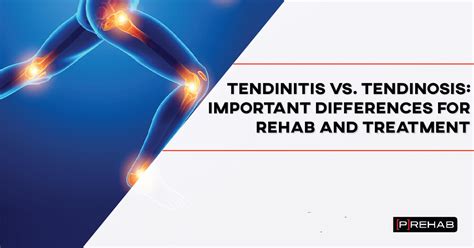 Tendinitis Versus Tendinosis: Important Differences For Rehab And ...