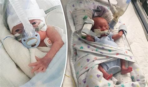 Miracle premature baby survives being born at just 22 weeks | Express.co.uk