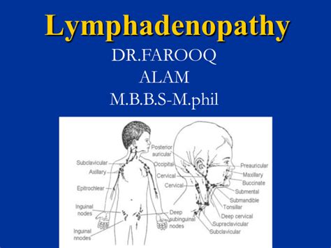 Lymphadenopathy in Children