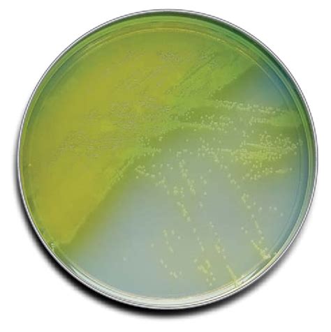 BD BBL™ Prepared Plated Media: Pseudosel™ Agar (Cetrimide Agar) | Fisher Scientific