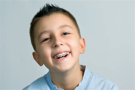 Scared Straightened: How to Prepare Kids Getting Braces