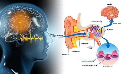 Luhaka AcuPeace Tinnitus Relief Device | W i z z g o o