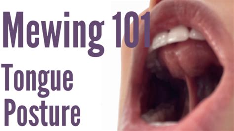 Mewing | Keep Correct Tongue Posture