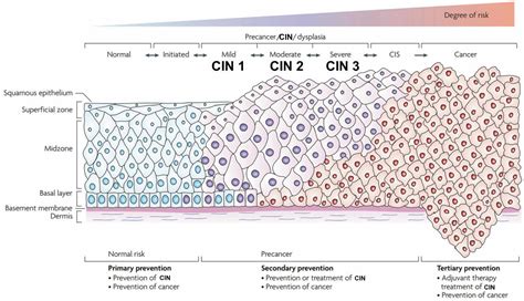 Cervical intraepithelial neoplasia grade 1, 2 and 3, definition and treatment