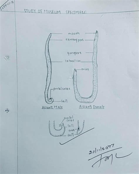 Nematoda Study: Ascaris, Wuchereria bancrofti-Comments & Diagram