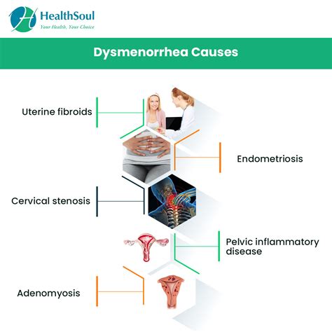 Dysmenorrhea: Causes and Treatment – Healthsoul