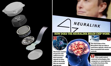 Elon Musk says first human patient implanted with a Neuralink brain ...