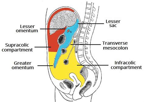 Retroperitoneal bleed causes, symptoms, diagnosis & treatment