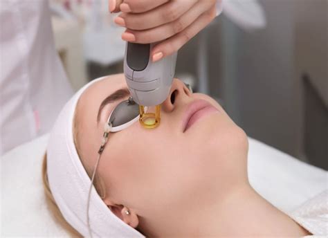 Best Laser Treatment For Acne Scars: Laser Acne Scar Removal