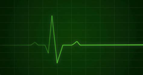 Concept Animation Of Ecg Ekg Heartbeat Stock Motion Graphics SBV ...