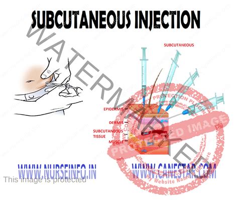 Subcutaneous Injection