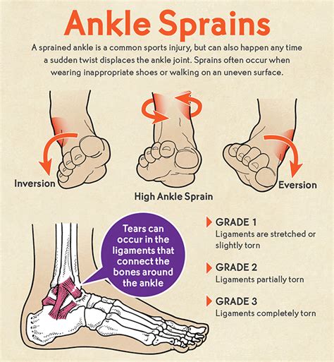 Common Injury for an Athlete – Ankle Sprain | Boulder County Foot & Ankle