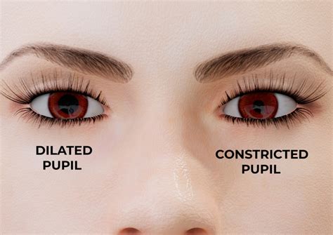 Understanding Eye Miosis: Causes, Symptoms, and Treatment - World Eye Care Foundation