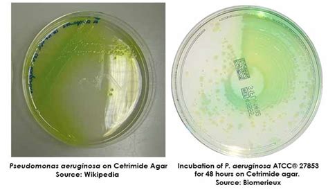 Cetrimide Agar- Composition, Principle, Uses, Preparation and Colony Morphology