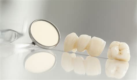 Dental Restoration at Perfect Place - Preffered Dental Care, Davie