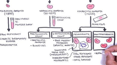 Anaemia (anemia) - classification (microcytic, normocytic and ...