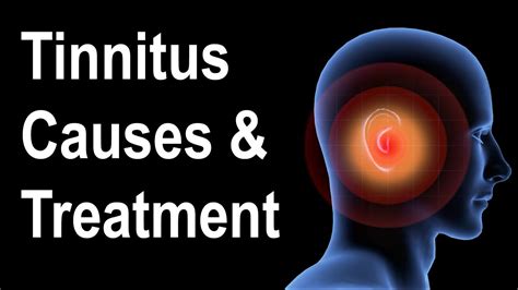 What is Tinnitus? Causes & Treatment Strategies - Go IT