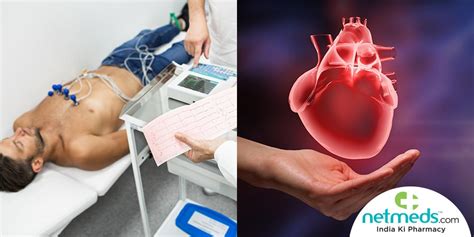 How Is An Ecg Test Performed: A Step-By-Step Guide