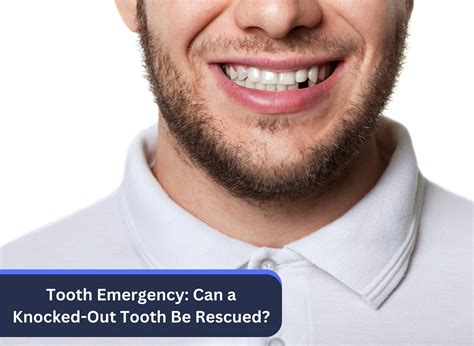 Tooth Emergency: Can a Knocked-Out Tooth Be Rescued?