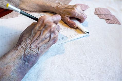 Elderly Arm Bruise Injury Stock Photos - Free & Royalty-Free Stock ...