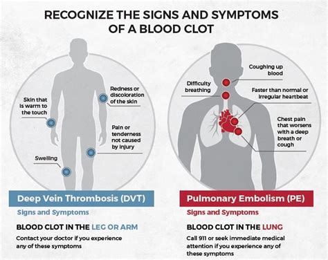 Blood Clot In Knee Symptoms