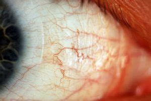 Sclera – Macroscopic Solutions | INSPIRING DISCOVERY