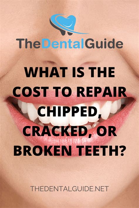 What is the Cost to Repair Chipped, Cracked, or Broken Teeth? - The Dental Guide